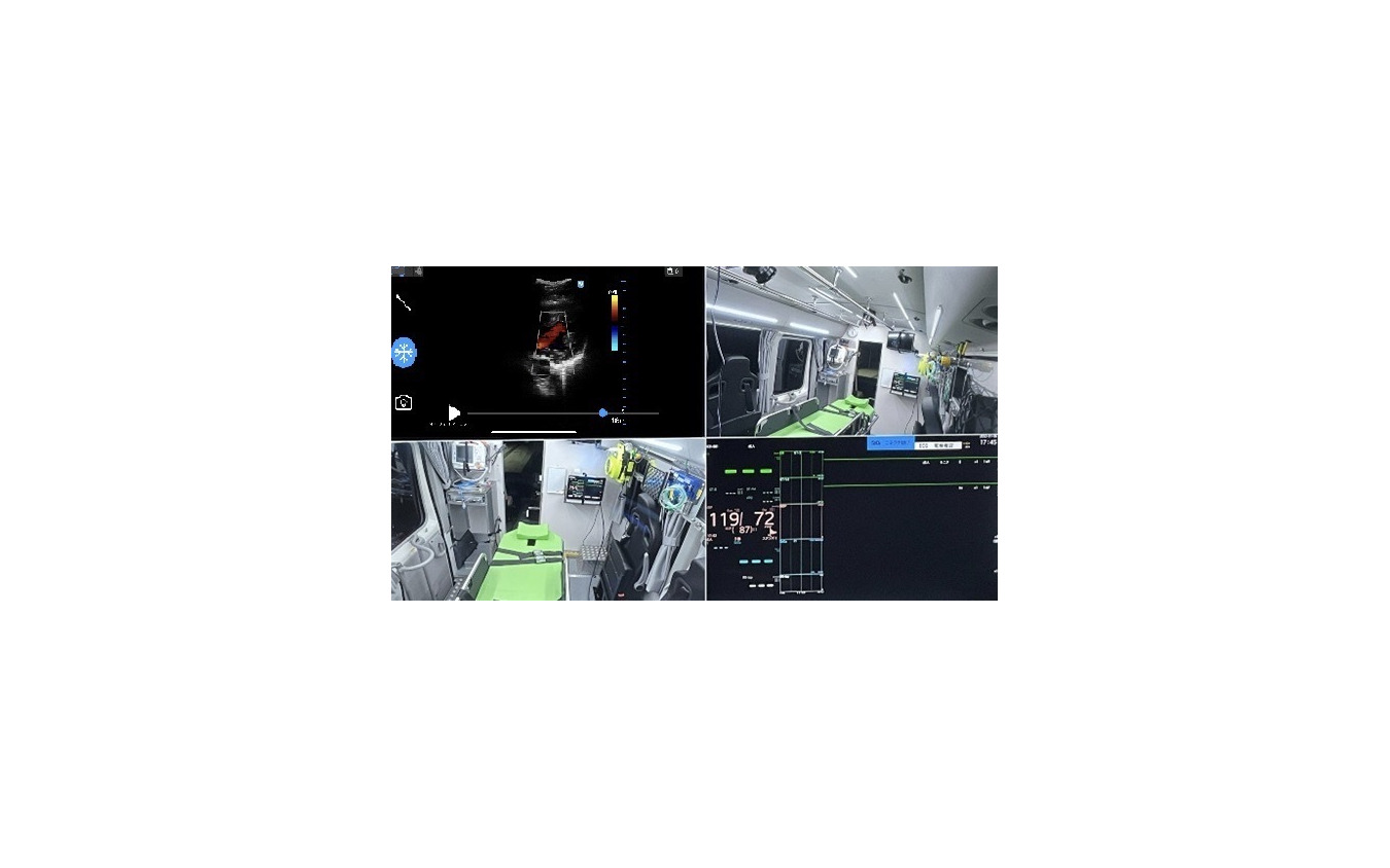 エクモカー内から送られる映像イメージ。左上：患者のエコー画像、右上：車内のLiveU映像、左下：車内のLiveU映像、右下：患者の血圧などの医用情報（バイタルデータ）