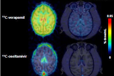 子どもの脳はタミフルの影響を受けやすい…理研ら確認 画像