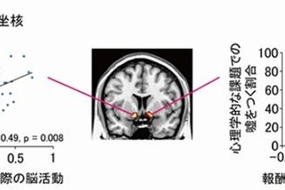 正直者と嘘つきの脳の違いを解明…京大研究グループ 画像