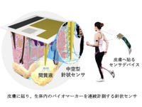本田技術研究所、皮膚に貼る新型センサー共同開発…血糖値の連続モニタリングが可能に 画像