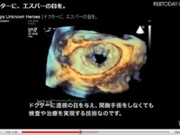 人体3D透視技術など、フィリップスの知られざる技術がネットに 画像
