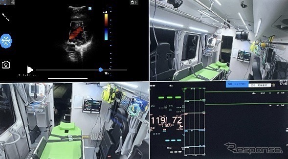 エクモカー内から送られる映像イメージ。左上：患者のエコー画像、右上：車内のLiveU映像、左下：車内のLiveU映像、右下：患者の血圧などの医用情報（バイタルデータ）