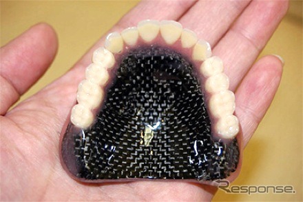 カーボン繊維強化型入れ歯