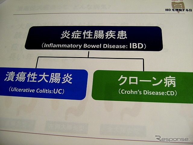 炎症性腸疾患はクローン病と潰瘍性大腸炎の2つの疾患からなる