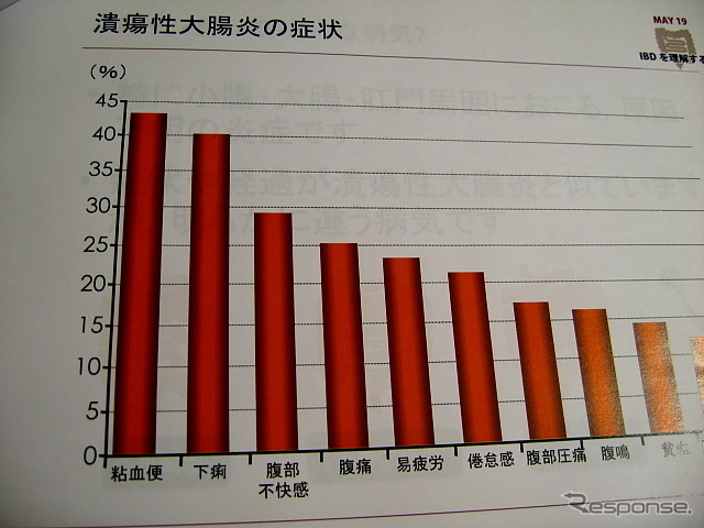 潰瘍性大腸炎の症状