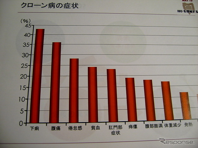 クローン病の症状
