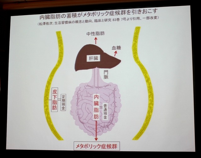 内臓脂肪の蓄積がメタボリック症候群を引き起こす
