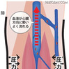 「JETLEGS」は一般医療機器として認定を受けており、市販のサポートストッキングよりも高い圧迫圧で血流をスムーズにする（画像はプレスリリースより）