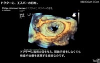人体3D透視技術など、フィリップスの知られざる技術がネットに 画像