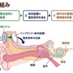 人工内耳の仕組み