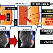 ヒップの構造と加齢変化する要因