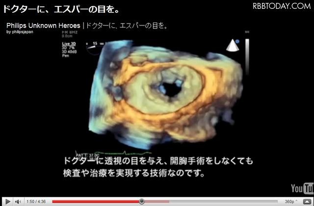 ムービー「人体を、3Dで透視する」の一場面 ムービー「人体を、3Dで透視する」の一場面