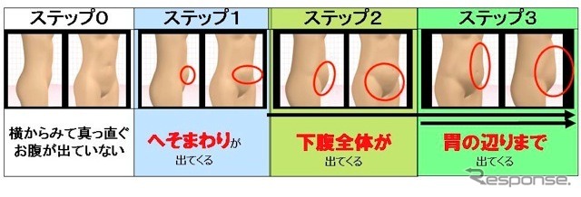 加齢によるおなかの形が変化する法則。変化は大きく分けて3段階