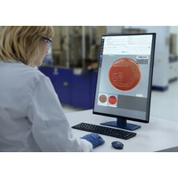 FDAの市販前認可510（k）により、CopanのPhenoMATRIX（R）の広範な用途が認められ、臨床微生物学の可能性が拡大